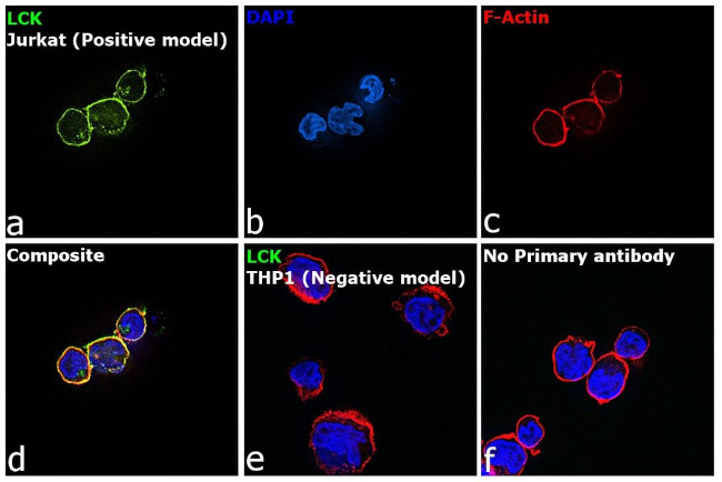 LCK Antibody in Immunocytochemistry (ICC/IF)