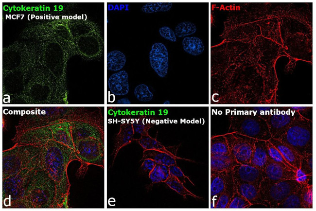 Cytokeratin 19 Antibody