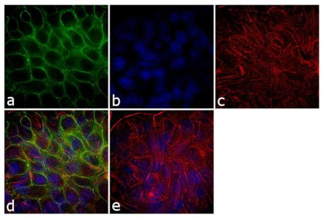 EpCAM Antibody in Immunocytochemistry (ICC/IF)