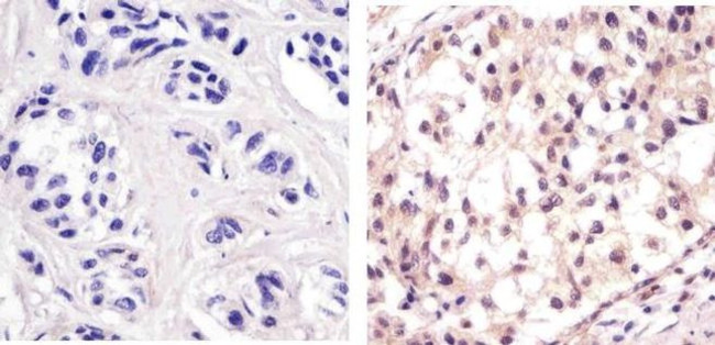 p53 Antibody in Immunohistochemistry (Paraffin) (IHC (P))