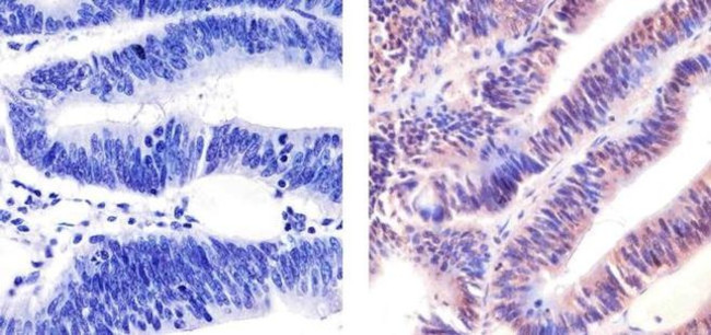 p53 Antibody in Immunohistochemistry (Paraffin) (IHC (P))