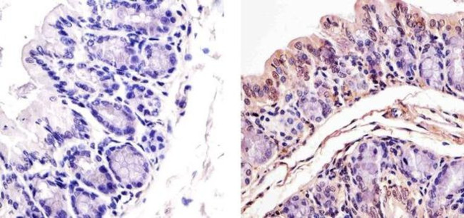 p53 Antibody in Immunohistochemistry (Paraffin) (IHC (P))