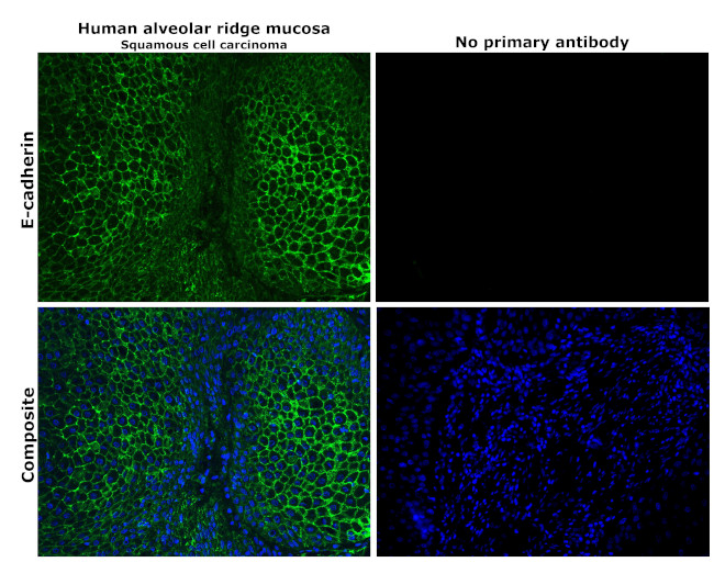 E-cadherin Antibody in Immunohistochemistry (Paraffin) (IHC (P))