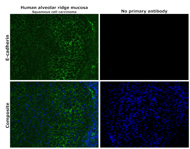 E-cadherin Antibody in Immunohistochemistry (Paraffin) (IHC (P))