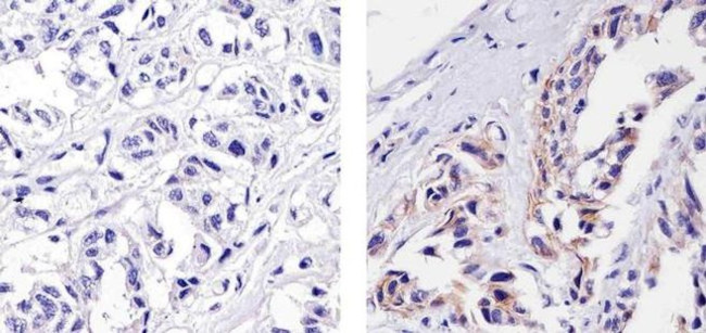 E-cadherin Antibody in Immunohistochemistry (Paraffin) (IHC (P))