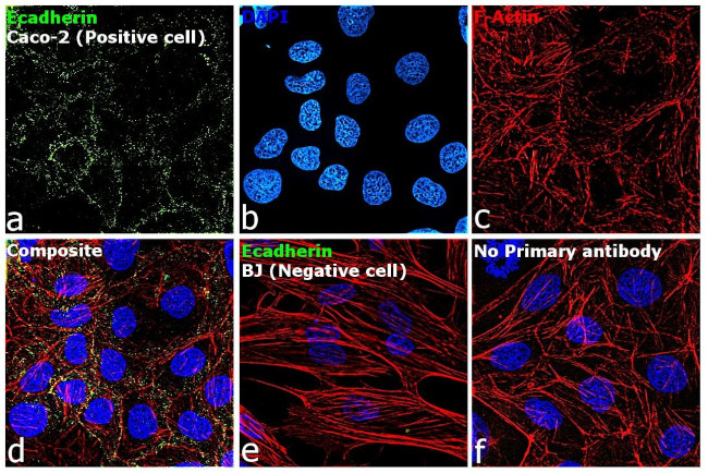 E-cadherin Antibody