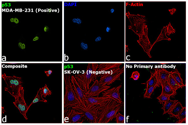 p53 Antibody in Immunocytochemistry (ICC/IF)