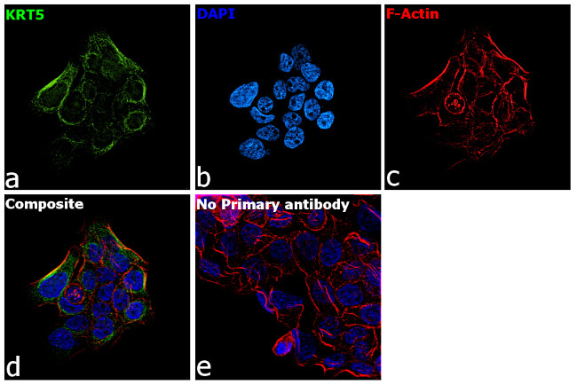 Cytokeratin 5 Antibody in Immunocytochemistry (ICC/IF)