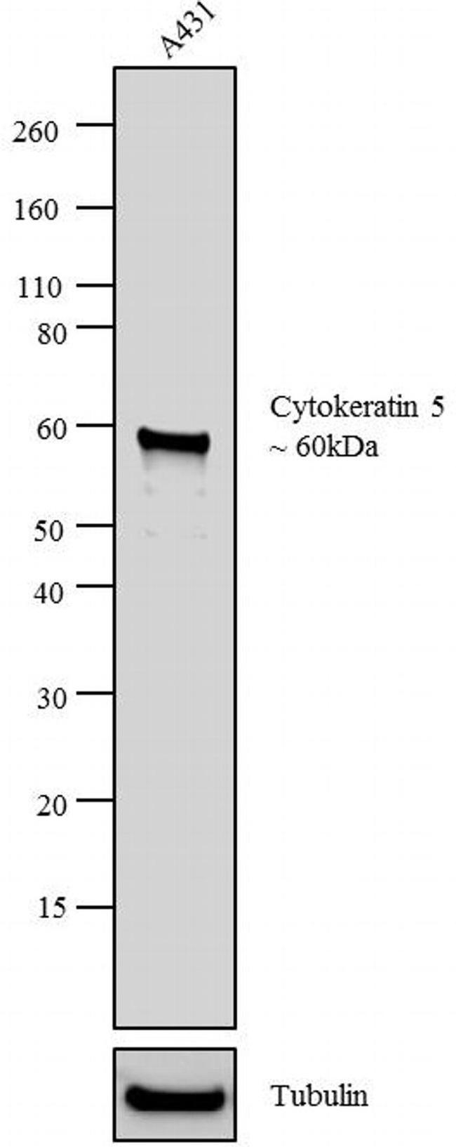 Cytokeratin 5 Antibody in Western Blot (WB)