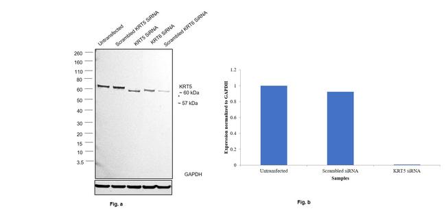 Cytokeratin 5 Antibody in Western Blot (WB)