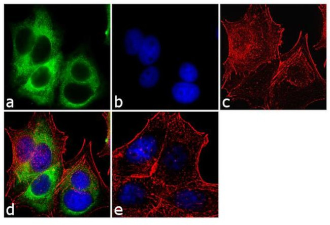 Cytokeratin 19 Antibody in Immunocytochemistry (ICC/IF)