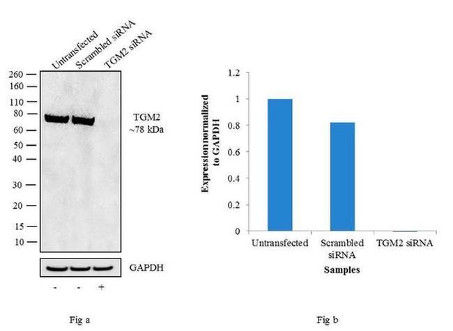 TGM2 Antibody in Western Blot (WB)