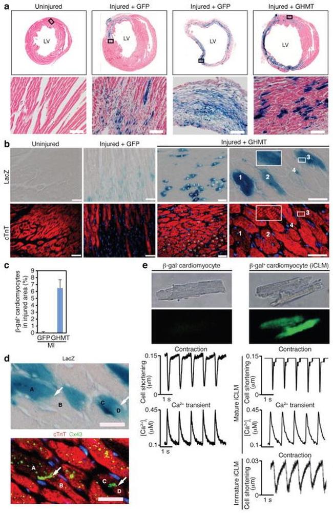 Collagen II Antibody in Immunocytochemistry (ICC/IF)