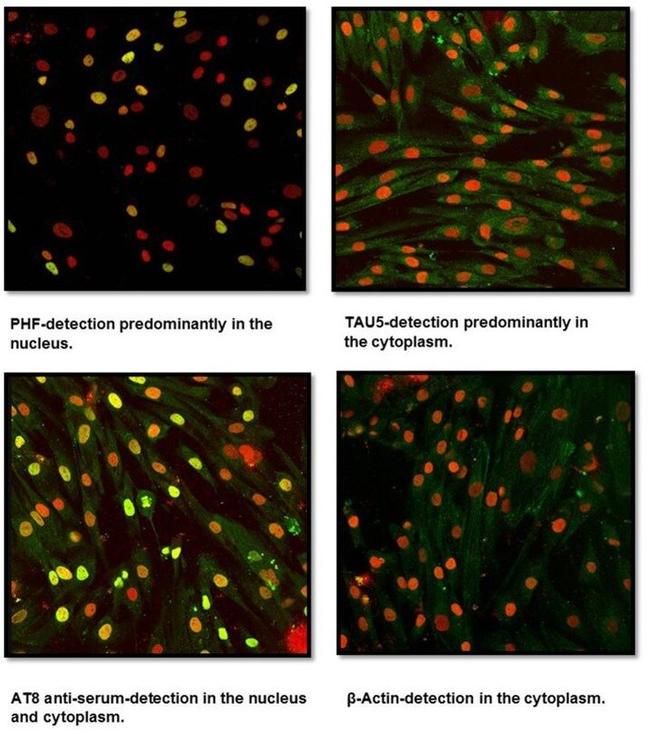 Tau Antibody in Immunocytochemistry (ICC/IF)