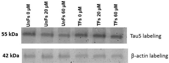 Tau Antibody in Western Blot (WB)