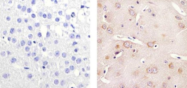 Tau Antibody in Immunohistochemistry (Paraffin) (IHC (P))