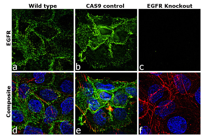 EGFR Antibody in Immunocytochemistry (ICC/IF)