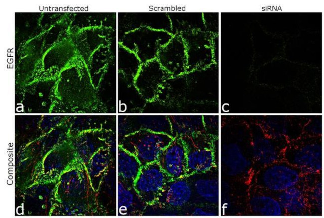 EGFR Antibody in Immunocytochemistry (ICC/IF)