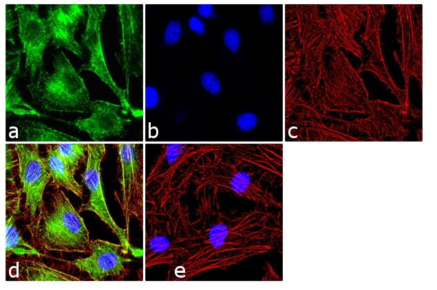 c-Kit Antibody in Immunocytochemistry (ICC/IF)