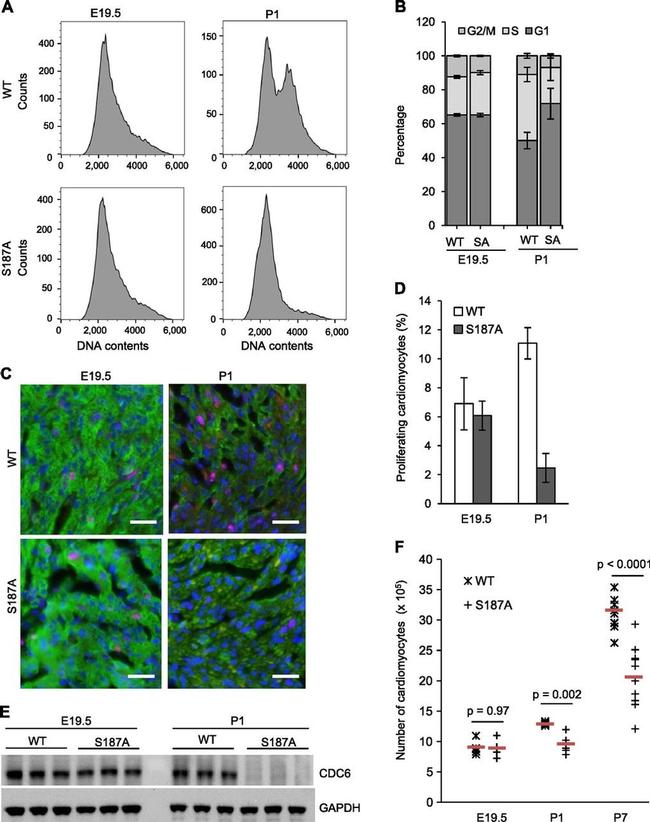 Cardiac Troponin T Antibody in Immunohistochemistry (Paraffin) (IHC (P))