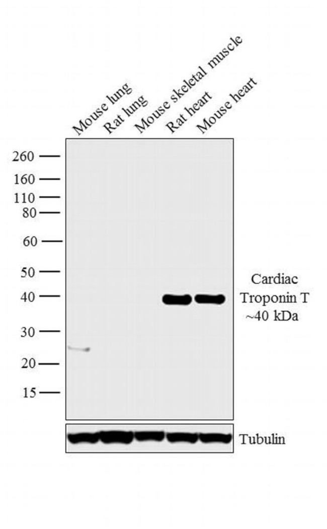 Cardiac Troponin T Antibody