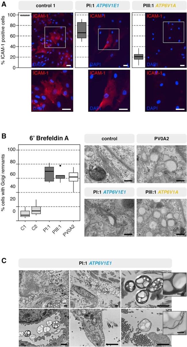 ICAM-1 Antibody in Immunocytochemistry (ICC/IF)