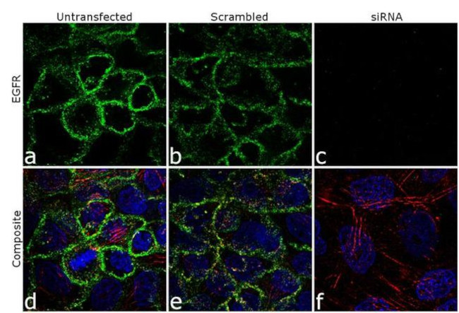 EGFR Antibody in Immunocytochemistry (ICC/IF)