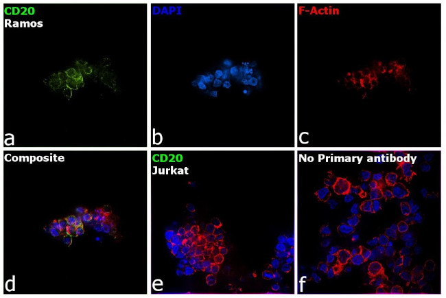 CD20 Antibody in Immunocytochemistry (ICC/IF)