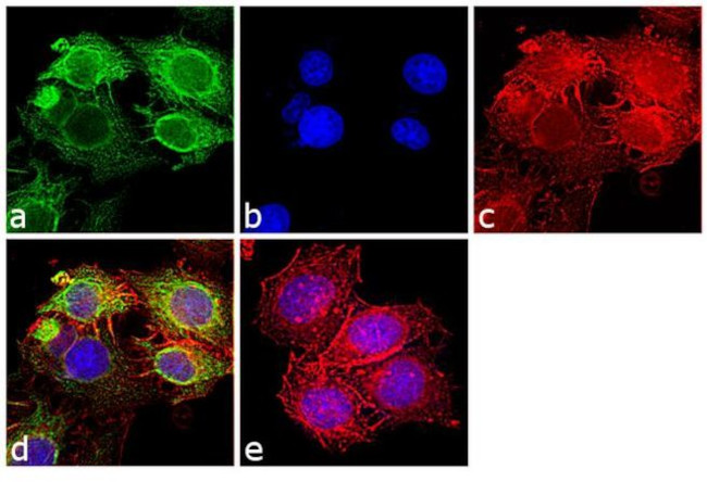 Cytokeratin Pan Type I Antibody in Immunocytochemistry (ICC/IF)