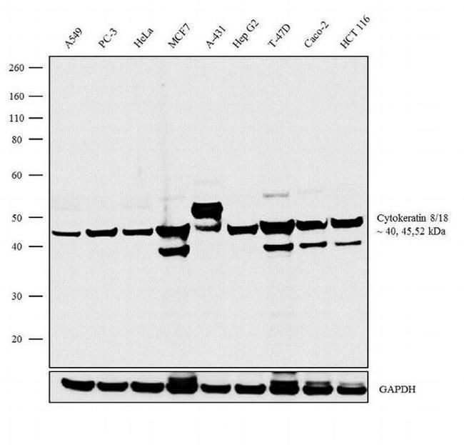 Cytokeratin Pan Type I Antibody in Western Blot (WB)