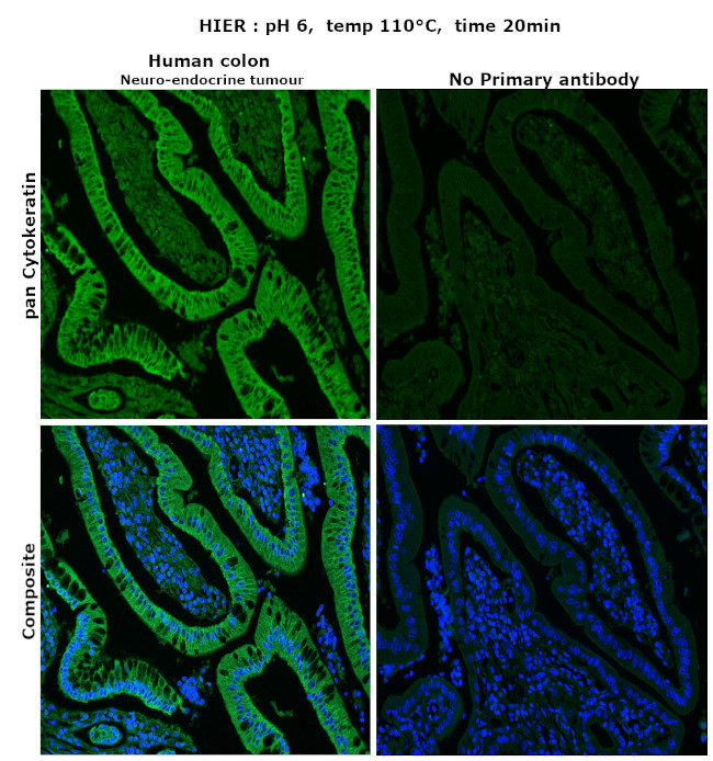 Cytokeratin Pan Type I/II Antibody in Immunohistochemistry (Paraffin) (IHC (P))