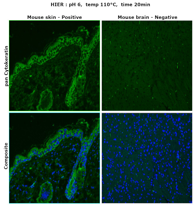 Cytokeratin Pan Type I/II Antibody in Immunohistochemistry (Paraffin) (IHC (P))