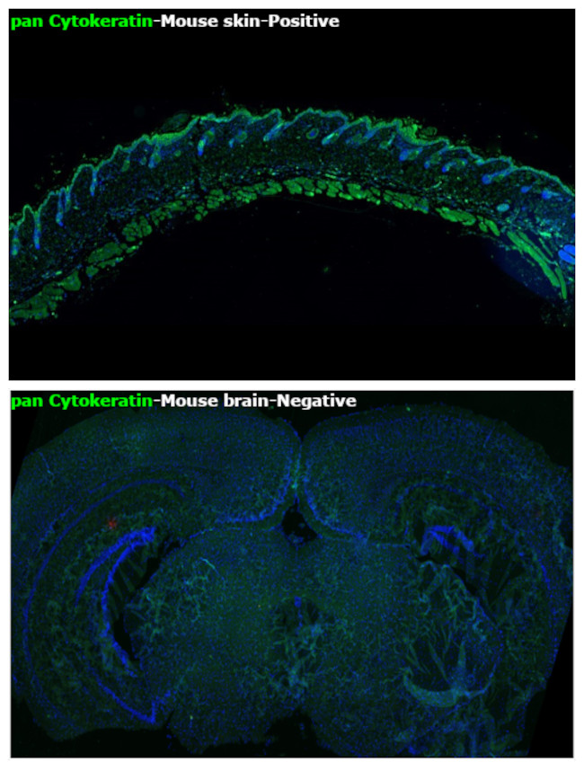 Cytokeratin Pan Type I/II Antibody