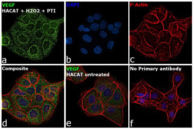 VEGF Antibody