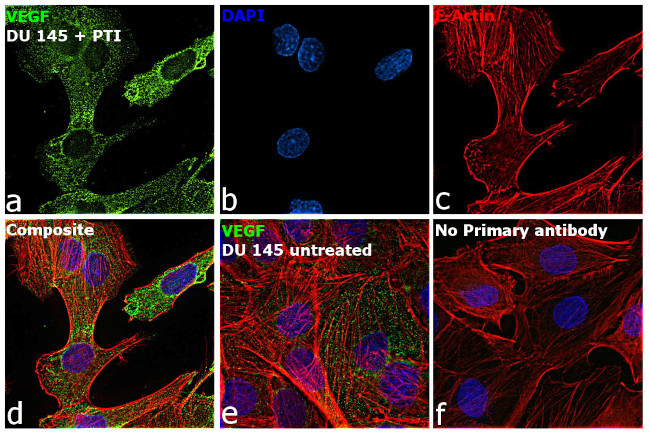 VEGF Antibody in Immunocytochemistry (ICC/IF)