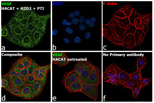 VEGF Antibody in Immunocytochemistry (ICC/IF)