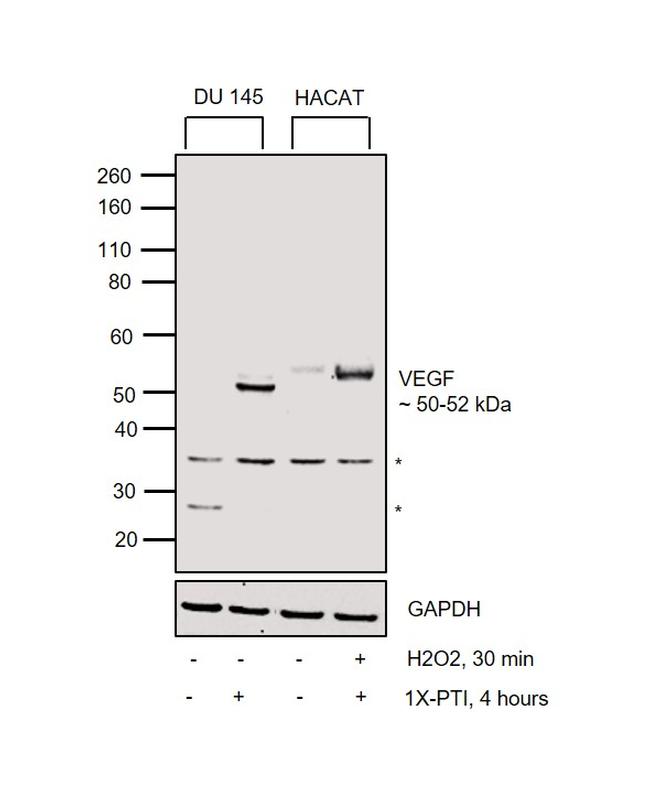 VEGF Antibody in Western Blot (WB)