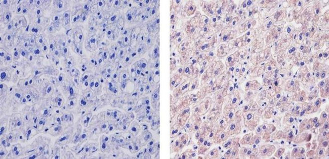 VEGF Antibody in Immunohistochemistry (Paraffin) (IHC (P))