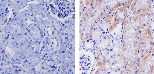 VEGF Antibody in Immunohistochemistry (Paraffin) (IHC (P))