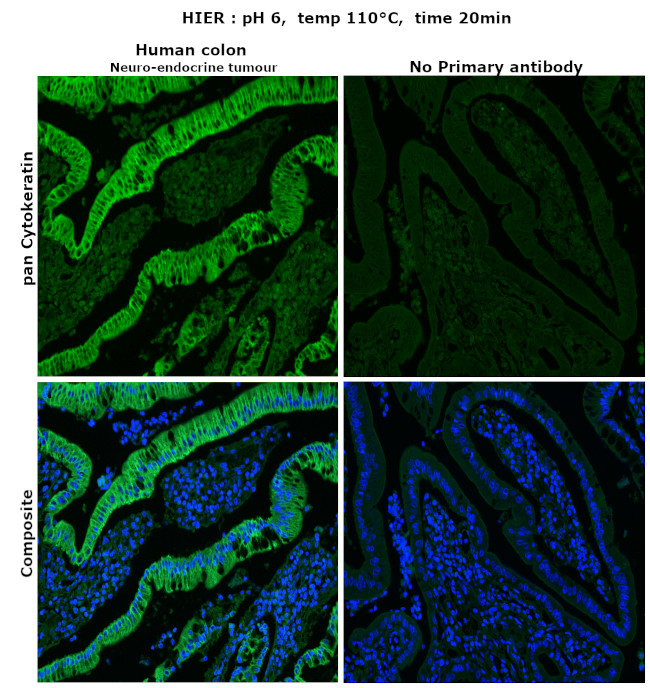 Cytokeratin Pan Antibody in Immunohistochemistry (Paraffin) (IHC (P))