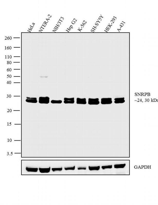 SNRPB Antibody in Western Blot (WB)