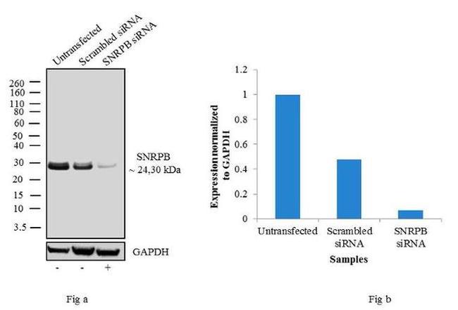 SNRPB Antibody in Western Blot (WB)