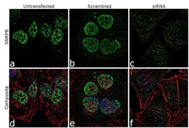 SNRPB Antibody in Immunocytochemistry (ICC/IF)