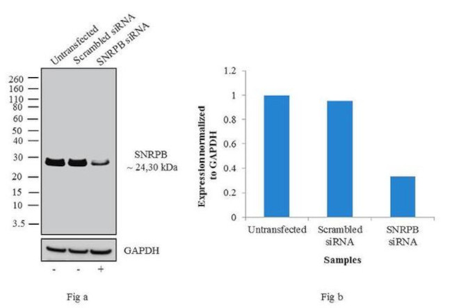 SNRPB Antibody