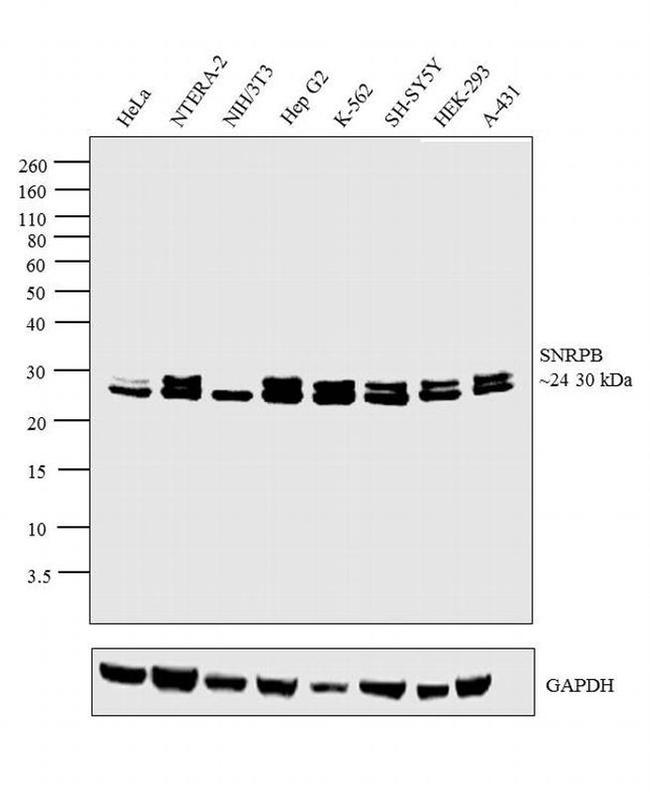 SNRPB Antibody in Western Blot (WB)