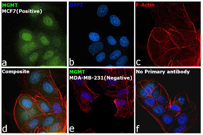 MGMT Antibody in Immunocytochemistry (ICC/IF)