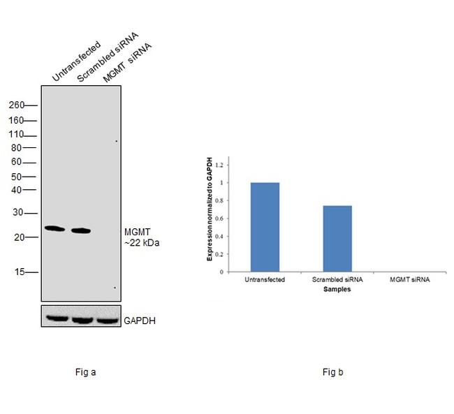 MGMT Antibody in Western Blot (WB)