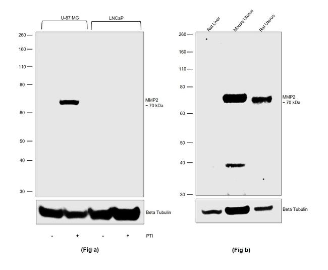 MMP2 Antibody in Western Blot (WB)