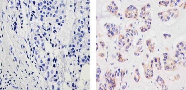 MMP2 Antibody in Immunohistochemistry (Paraffin) (IHC (P))