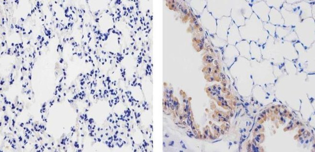 MMP2 Antibody in Immunohistochemistry (Paraffin) (IHC (P))